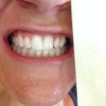 best teeth whitening strips white teeth next to white piece of paper